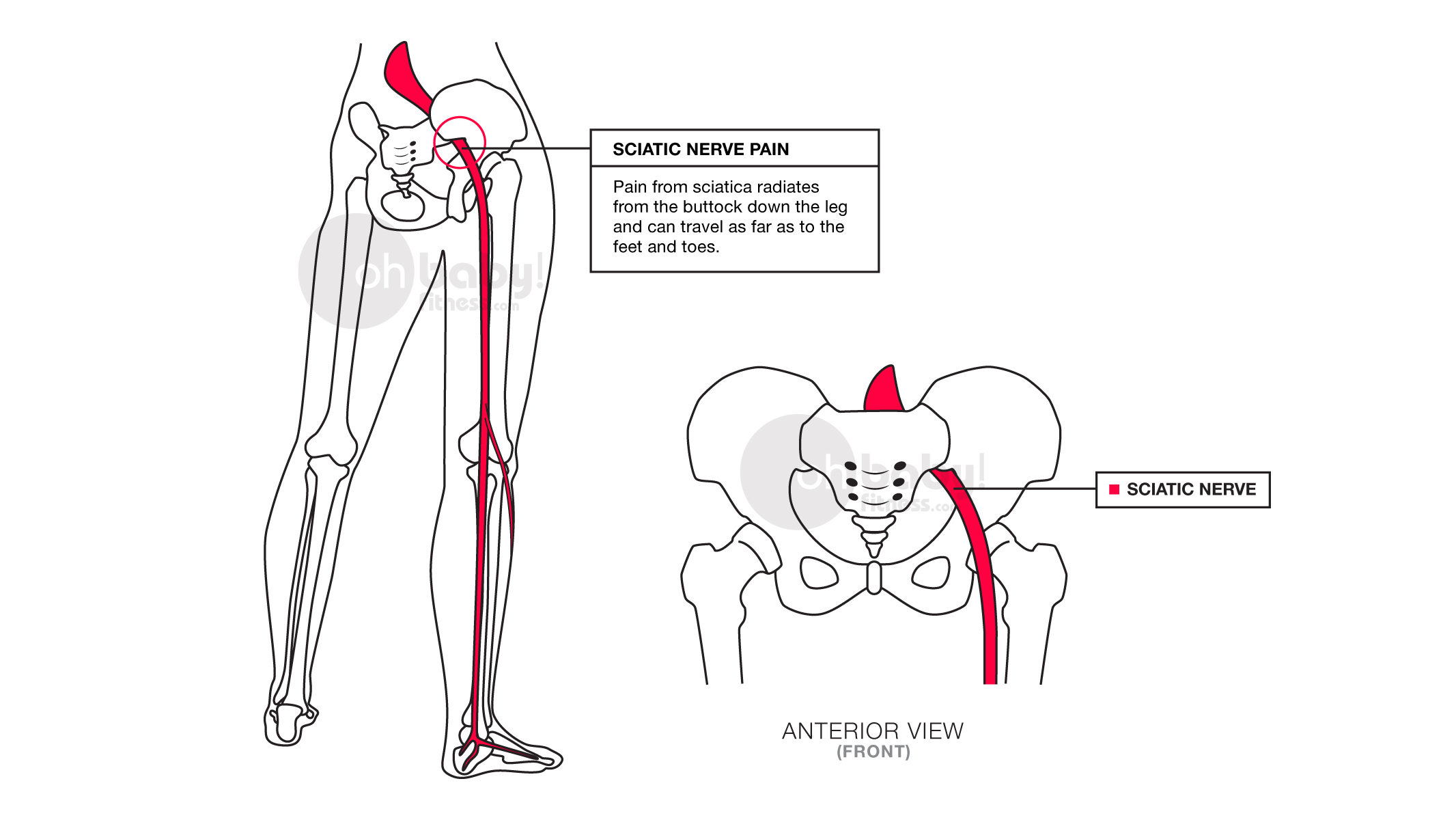 Tens Placement Chart Sciatica